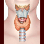 दुनिया में थायरॉइड कैंसर तेजी से बढ़ रहा, अमेरिका में दर सबसे अधिक—क्यों बढ़ रहे मामले?