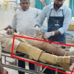 शिवहर अस्पताल में ‘जुगाड़’ से इलाज! घायल दरोगा के टूटे पैर को कार्टून और पाइप से बांधा, सिस्टम पर उठे सवाल