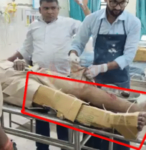 शिवहर अस्पताल में ‘जुगाड़’ से इलाज! घायल दरोगा&hellip;