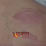 Bihar News: वैशाली में बेल तोड़ने के आरोप में 12 वर्षीय छात्र की बेरहमी से पिटाई, एक आरोपी गिरफ्तार