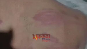 Bihar News: वैशाली में बेल तोड़ने के आरोप&hellip;